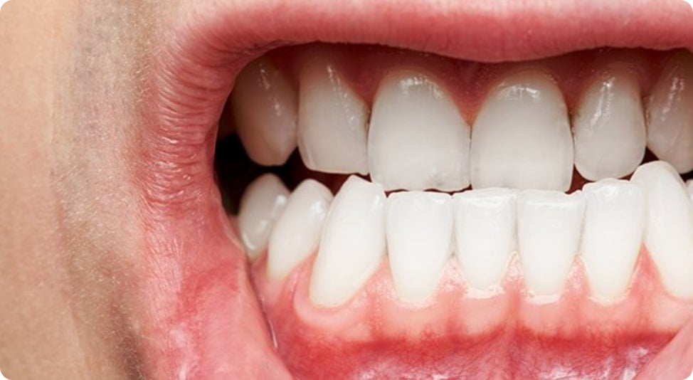 Can Black Mold Cause Periodontal Disease?-single blog image
