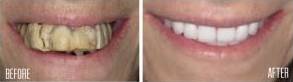 Before & After Patient Compilation-img7