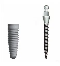 Mini Dental Implants-mini-dental-implants